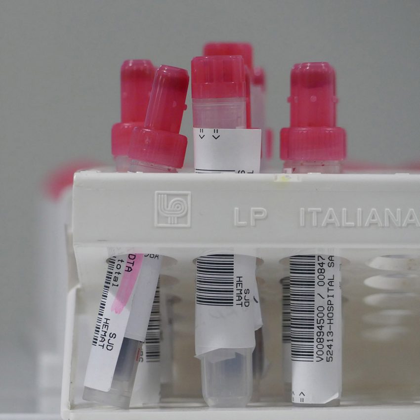 Hematologia-1 Consulta de hematólogos en Córdoba