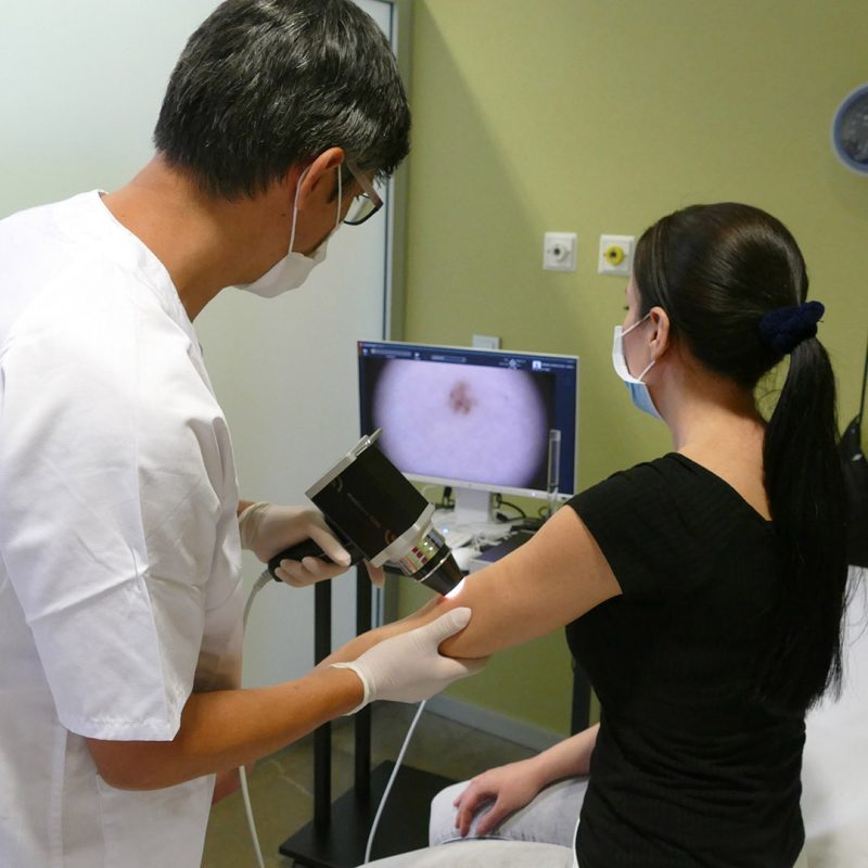 Consulta médica de Oncología Cutánea