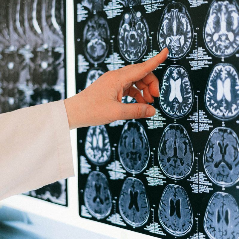 neurocirujano analizando una radiografía en el hospital de Córdoba