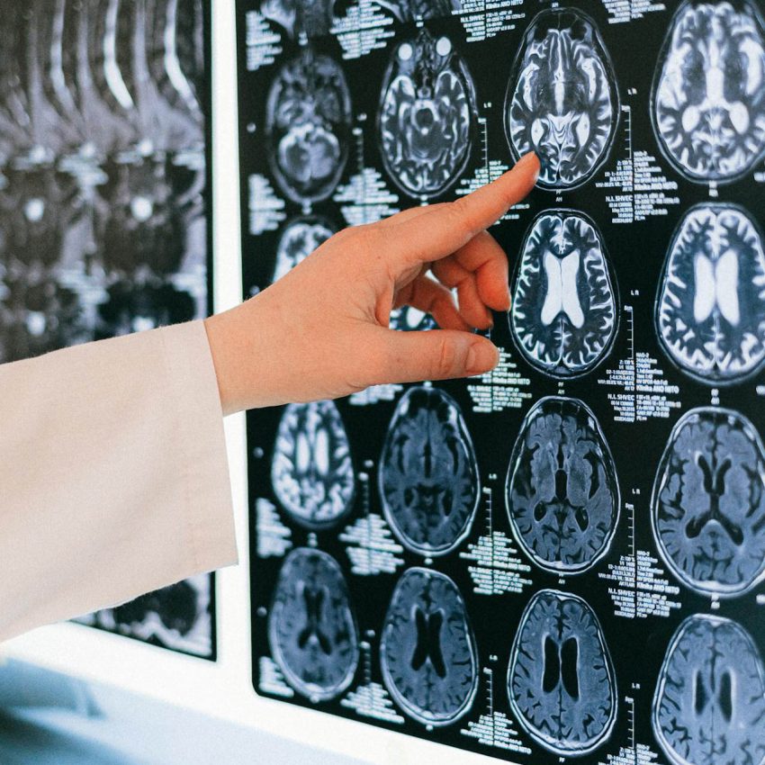 neurocirugia neurocirujano analizando una radiografía en el hospital de Córdoba